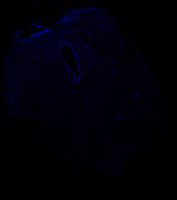 13PCW human midbrain